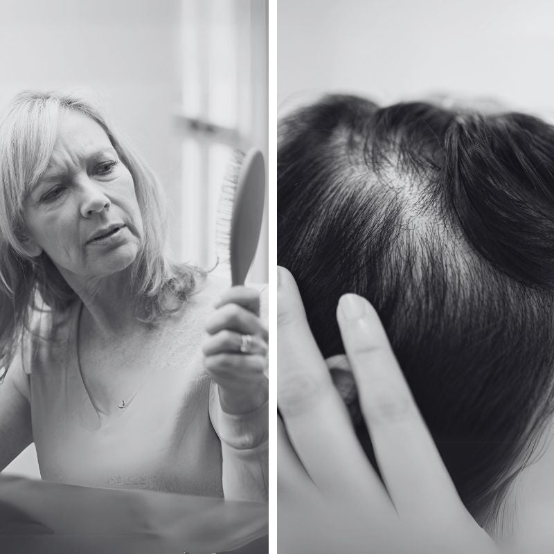 Left: older woman examining hairbrush; right: close-up of thinning hair and visible scalp